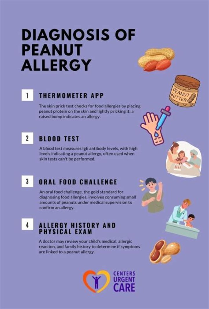 Can you eat at Five Guys if you have a peanut allergy?
