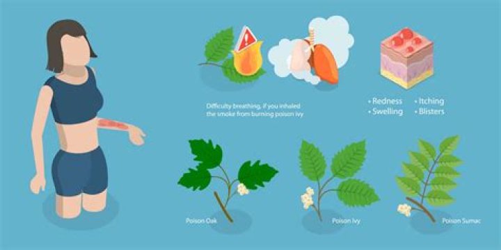 Can you have a delayed reaction to poison ivy?