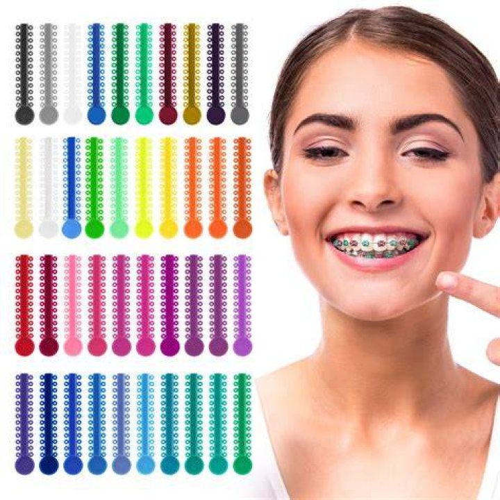 Can you kiss with braces Springs?