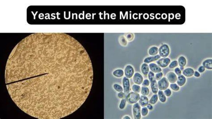 Can you see STD under microscope?