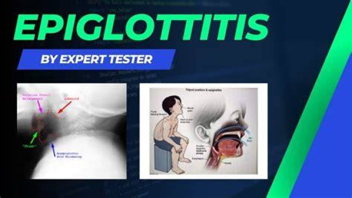 Can you touch your epiglottis?