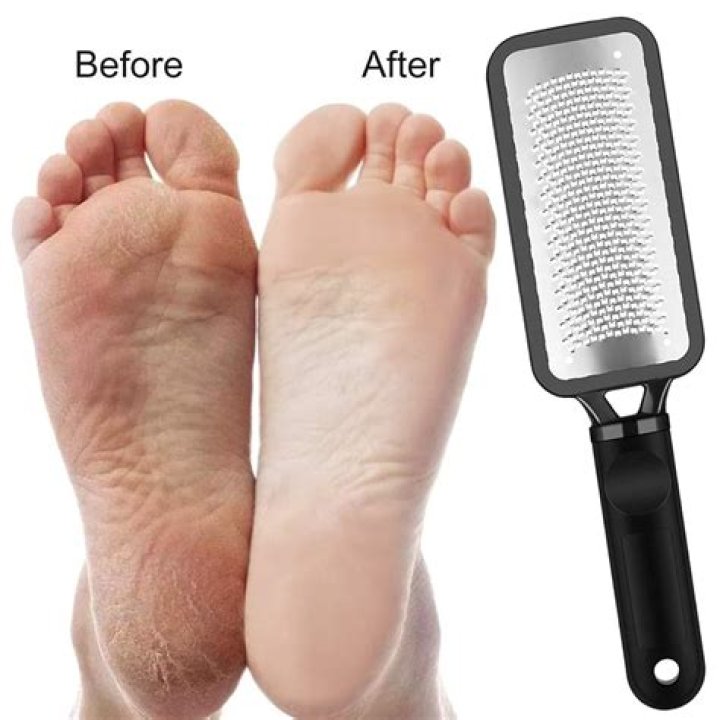Can you use a cheese grater on feet?