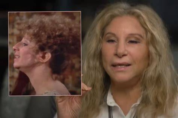 Did Barbra Streisand appear in Fiddler on the Roof?