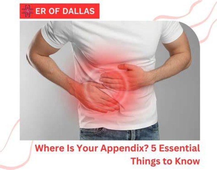 Does an appendix have to be on a separate page?