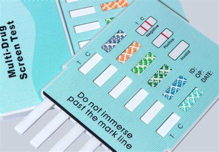 Does teleperformance random drug test?