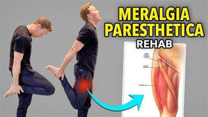 How can I sleep with Meralgia Paresthetica?