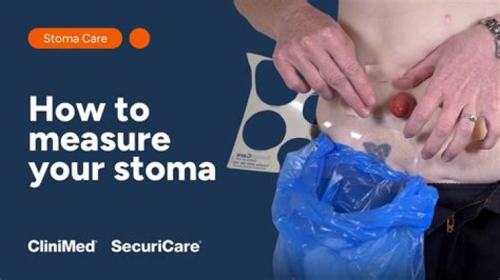 How do you document stoma appearance?