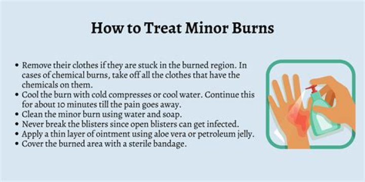How do you treat a chemical burn from acetone?