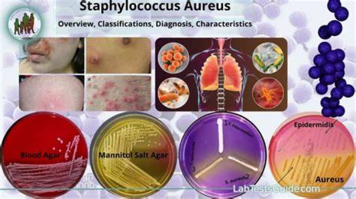 How is Staphylococcus aureus and Staphylococcus epidermidis distinguished?