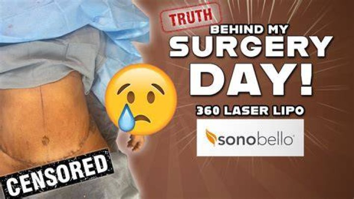How long does it take to see results from Sono Bello?