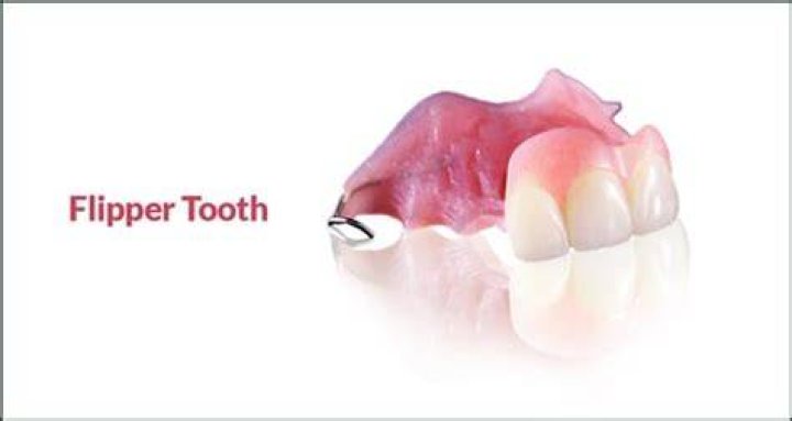 How much is a flipper tooth cost?