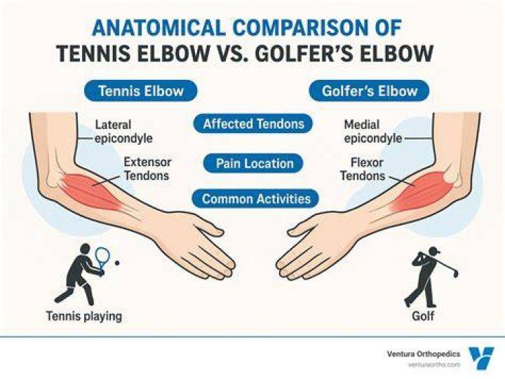 Is heat good for golfers elbow?