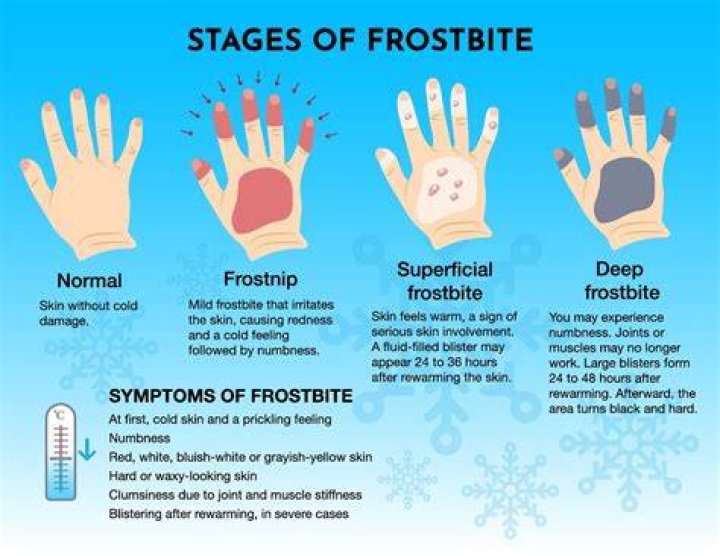 Is hot water bad for cold hands?