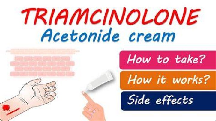 Is it okay to use expired triamcinolone acetonide cream?