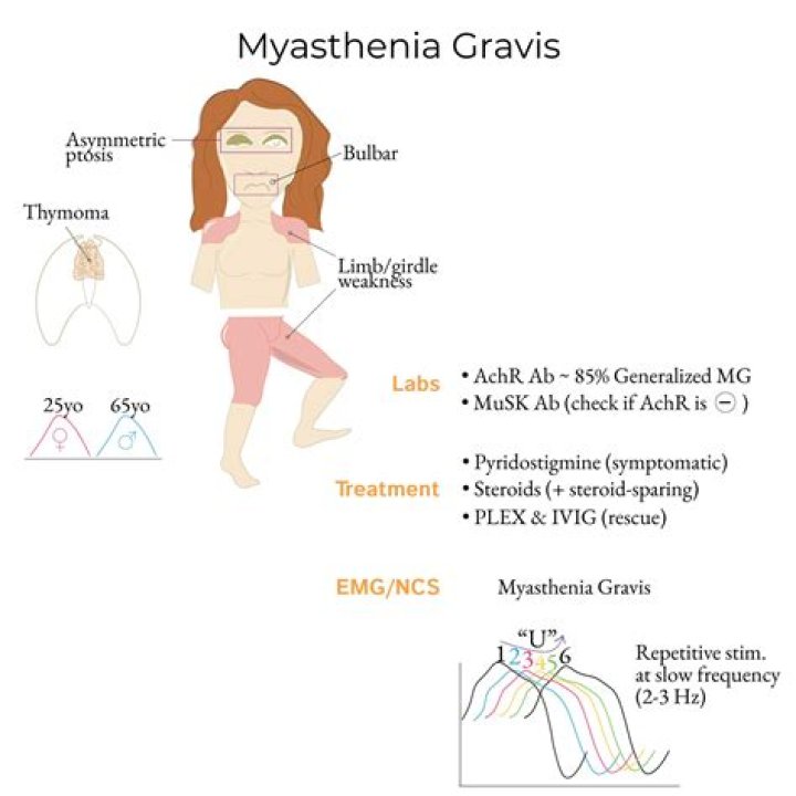 Is myasthenia gravis ascending or descending paralysis?