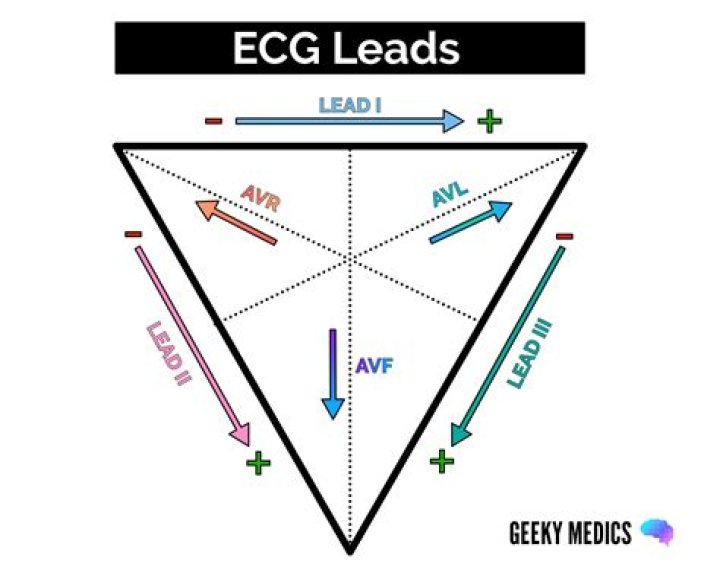 What are contiguous leads in ECG?