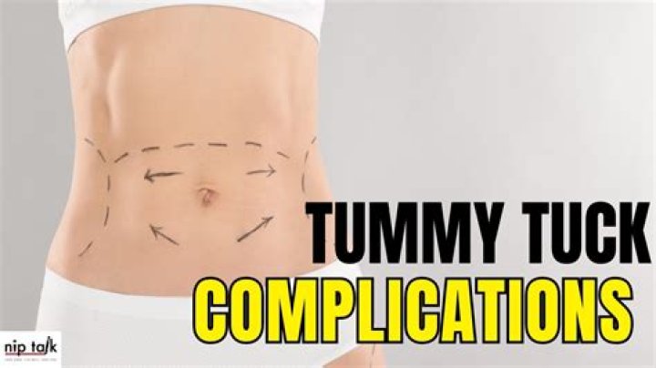What are the chances of dying from a tummy tuck?