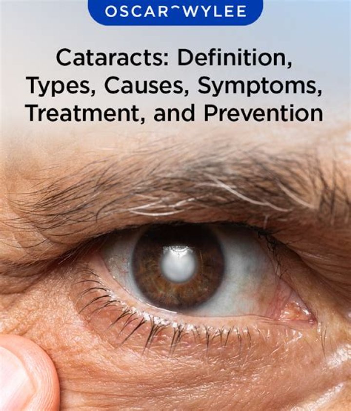 What caused the cataracts in the Nile?