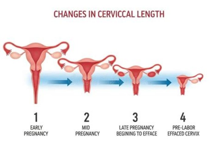 What causes a friable cervix during pregnancy?