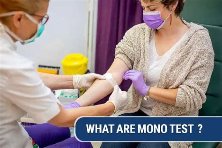 What does Monospot test for?