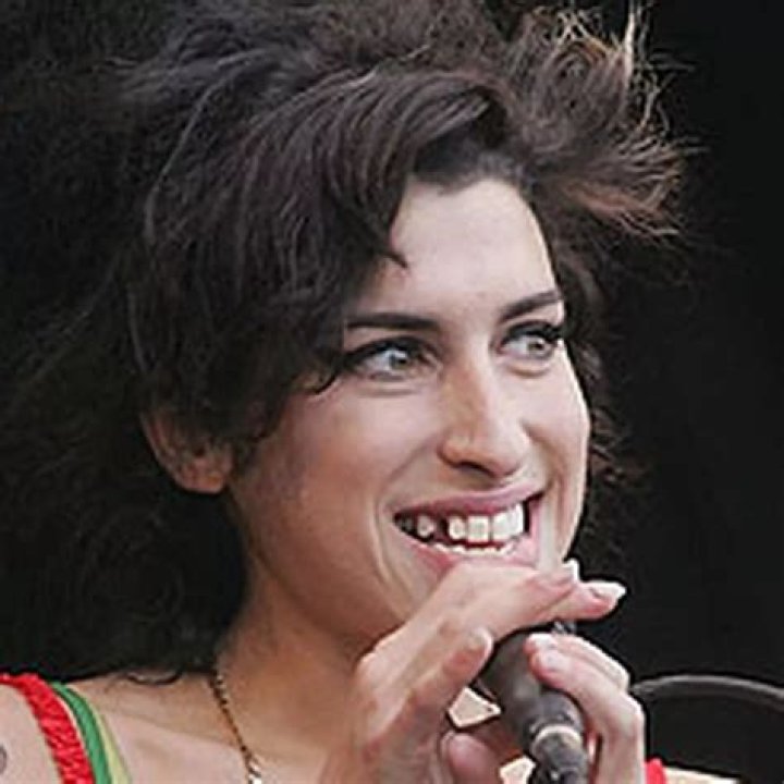 What happened amy winehouse teeth?