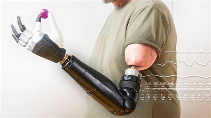 What is Bionics full name?