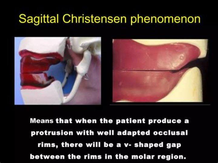 What is Christensen phenomenon?