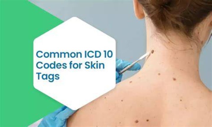 What is ICD 10 code for skin tag?