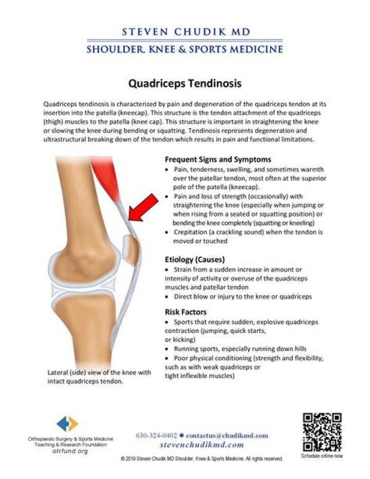 What is quadriceps Enthesopathy?