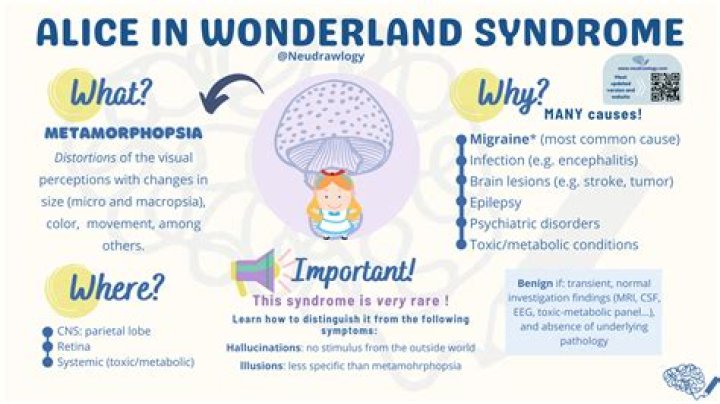 What is the Alice in Wonderland syndrome?