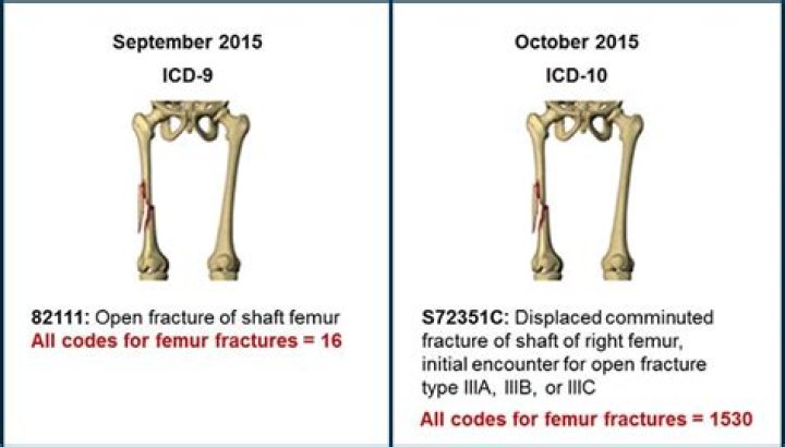 What is the ICD 10 code for left humeral fracture?