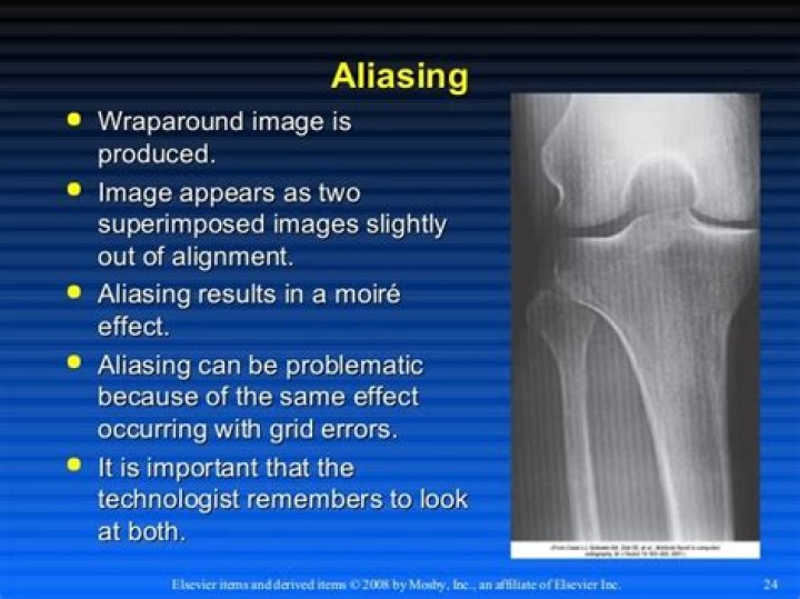 What is the moire effect in radiography?