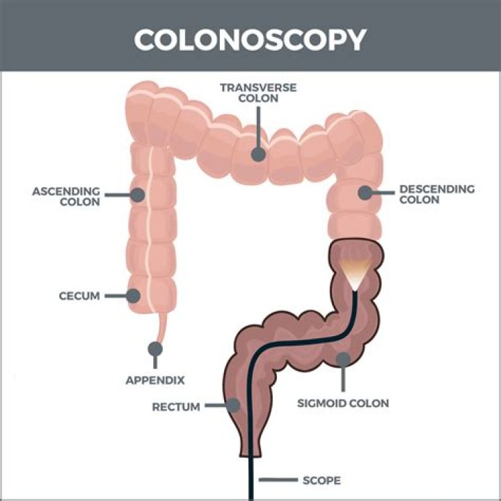 What is the suffix of colonoscopy?