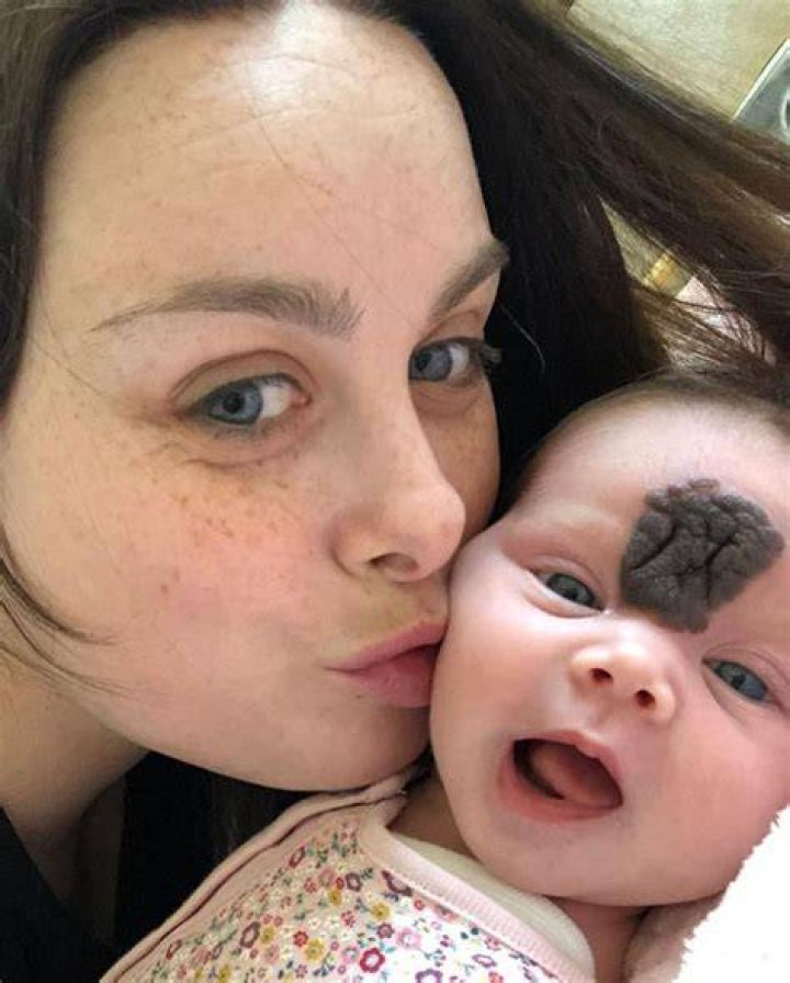 Who has an apple shaped birthmark on his head?