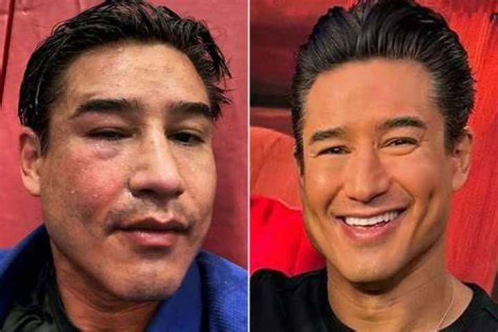 Who is Mario Lopez related to?