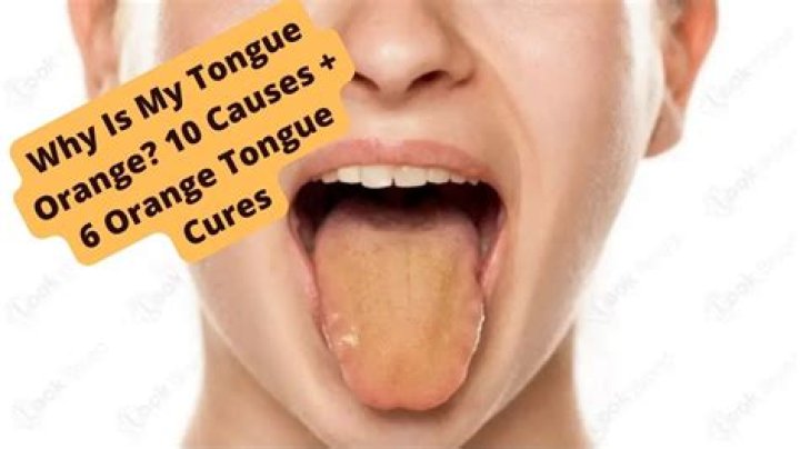 Why is my tongue orange and yellow?