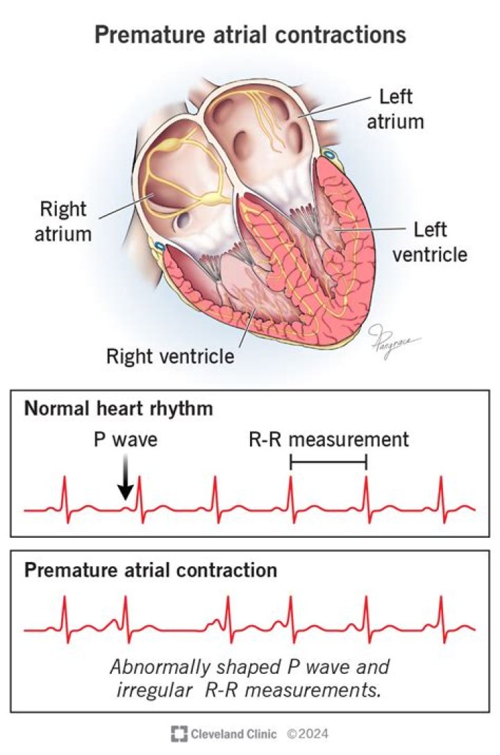 Why the larger waves seen on the oscilloscope represent ventricular contractions?