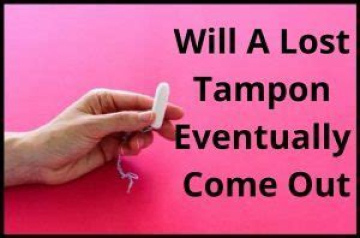Will a lost tampon eventually come out on its own?